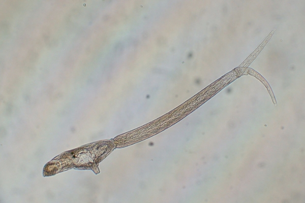 swimmers' itch schistosome